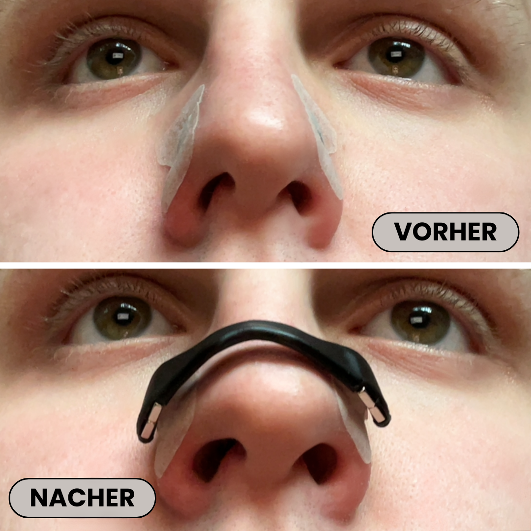 Magnetische Nasenstrips | Zoqa Starterpaket