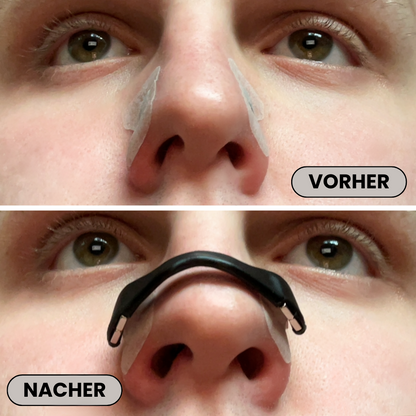 Magnetische Nasenstrips | Zoqa Starterpaket